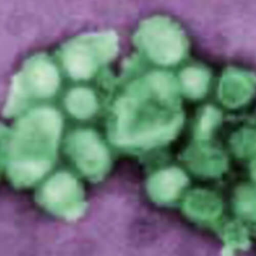 UV Light air purifier 5 germs 01